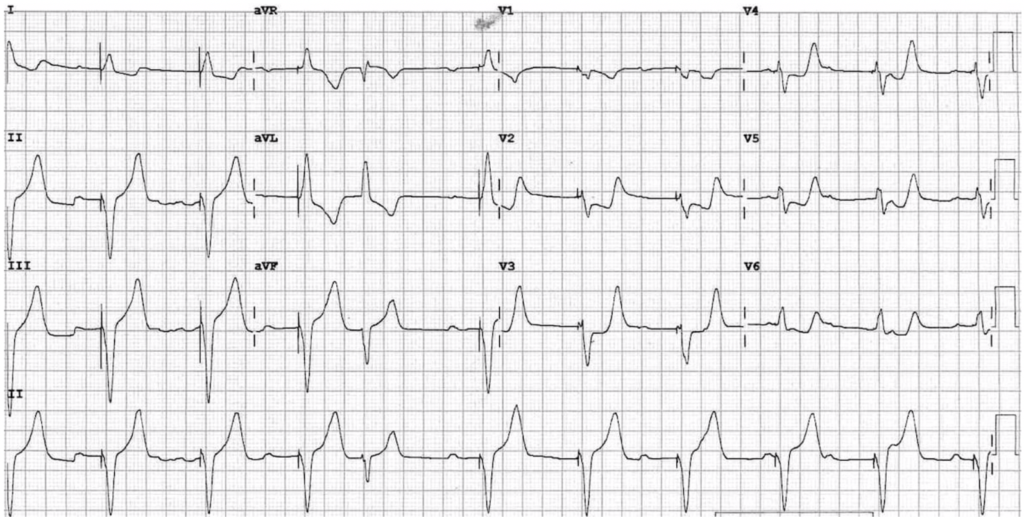 EKG (Electrocardiogram) - Calimed Wellness Center