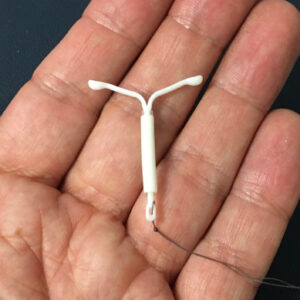 MIRENA IUD